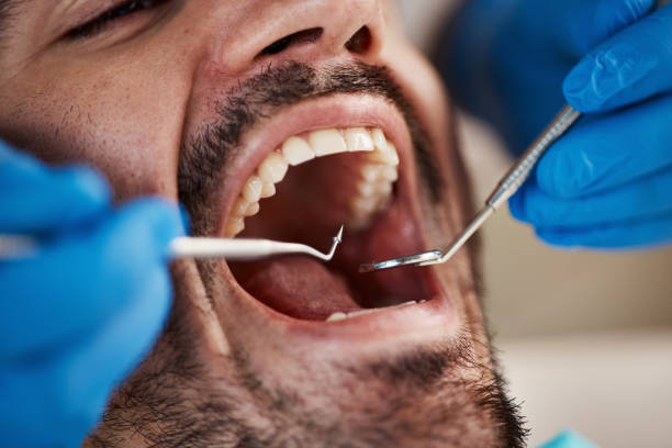 Best Emergency Denture Repair in Marrero, LA
